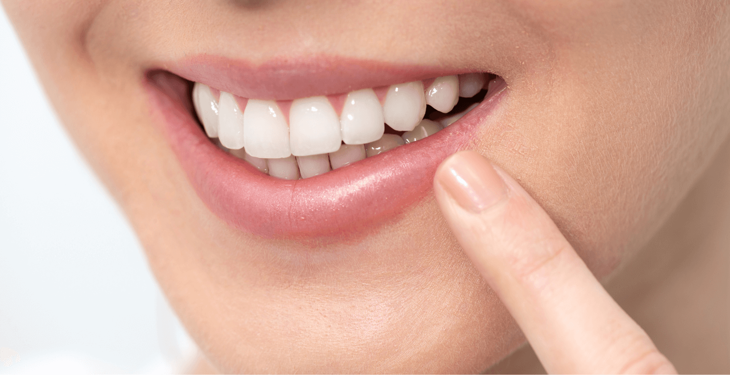 ホワイトニング